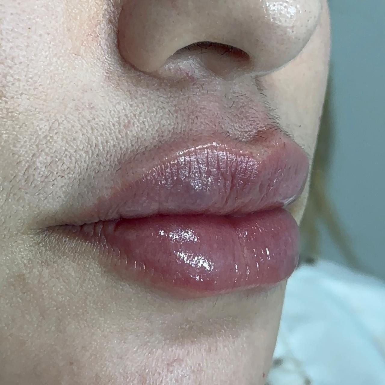 Después de Diseño de Labios