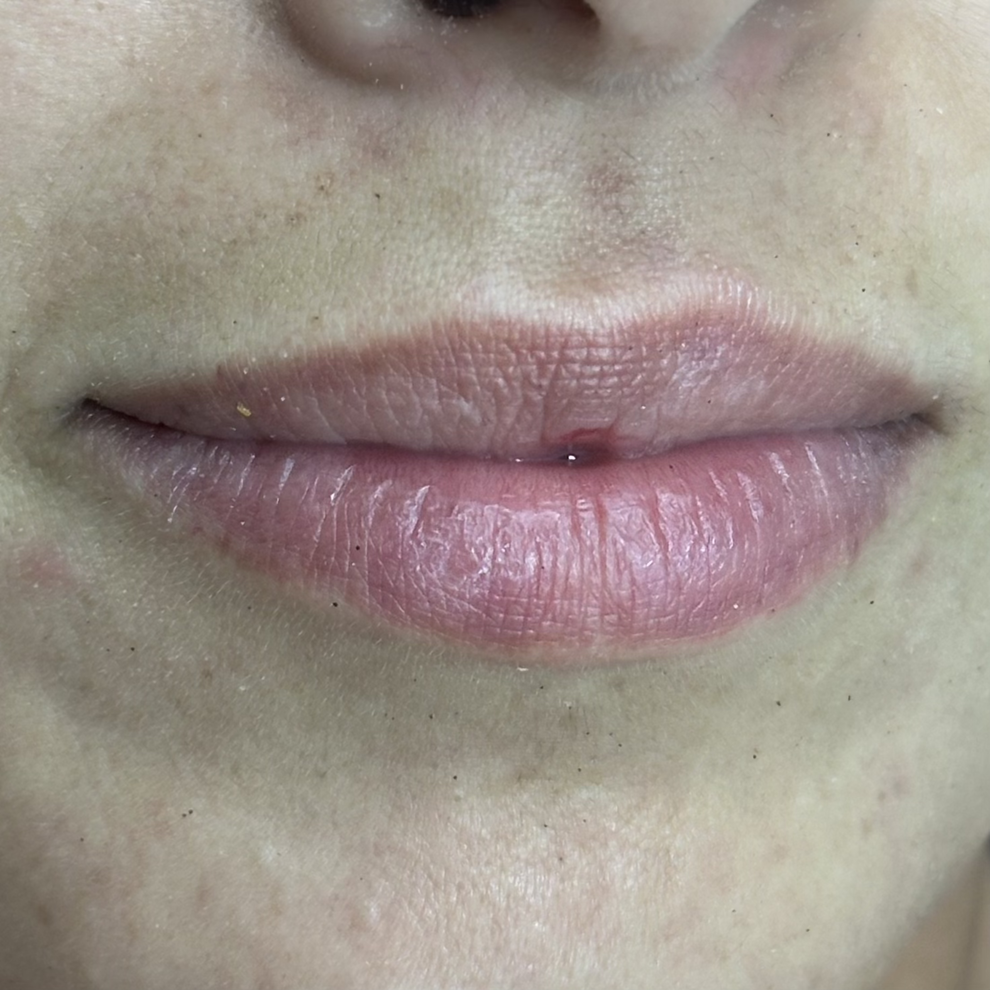 Antes de SS Heart Lips