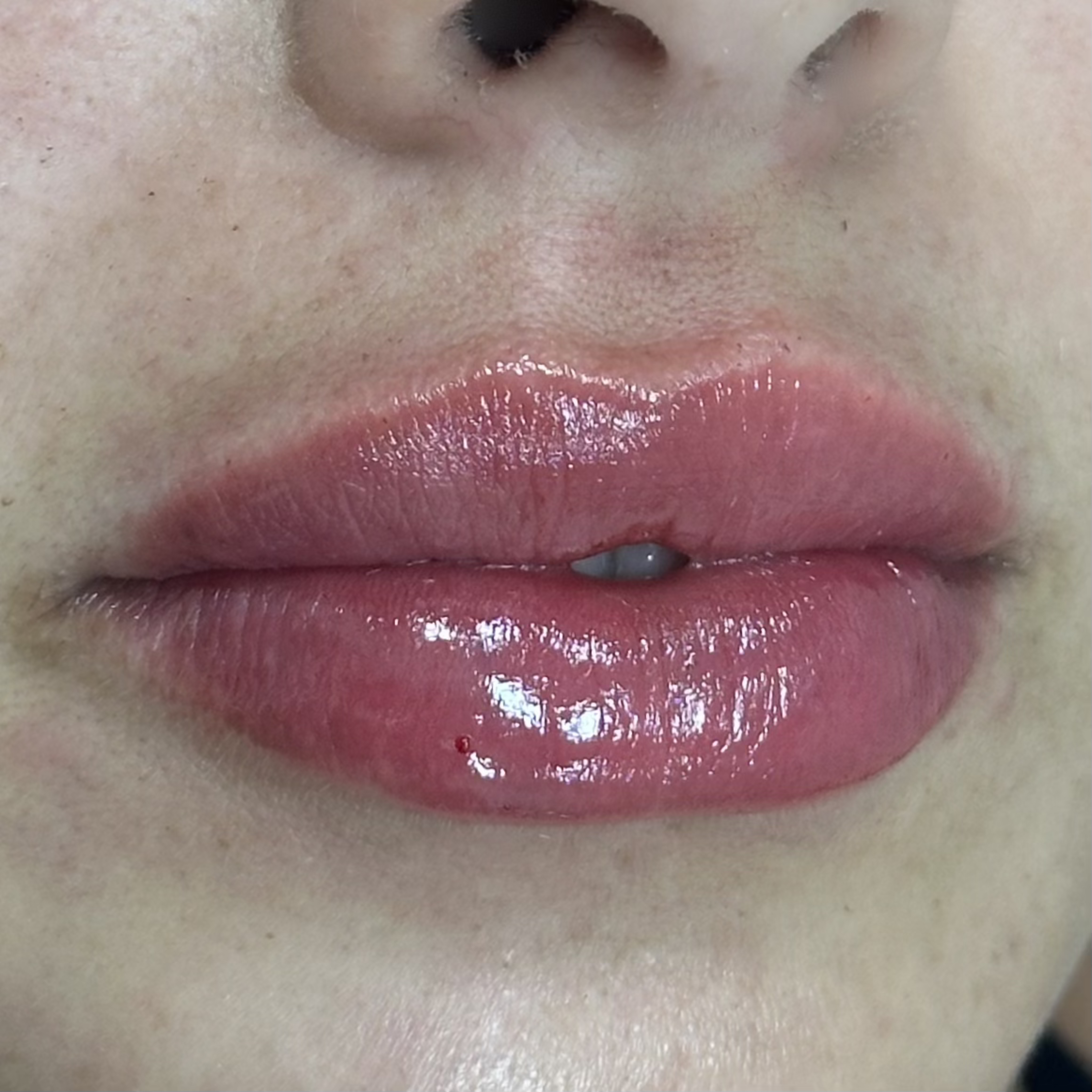 Después de SS Heart Lips